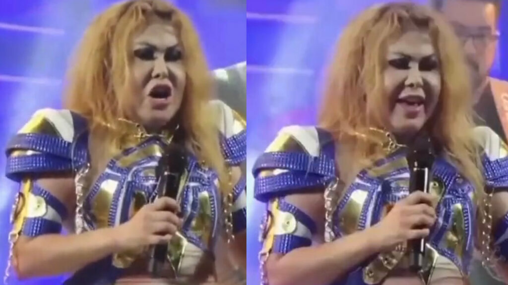 Joelma rosto inchado show