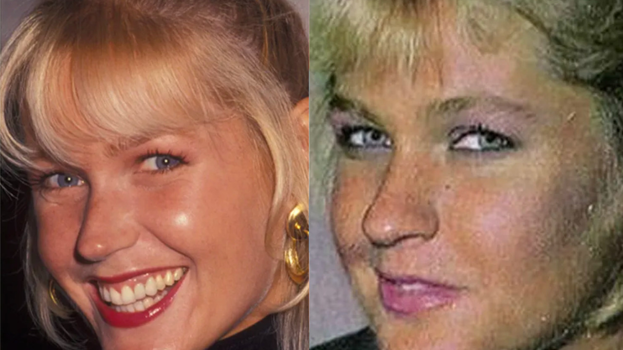 Mudança nariz de Xuxa