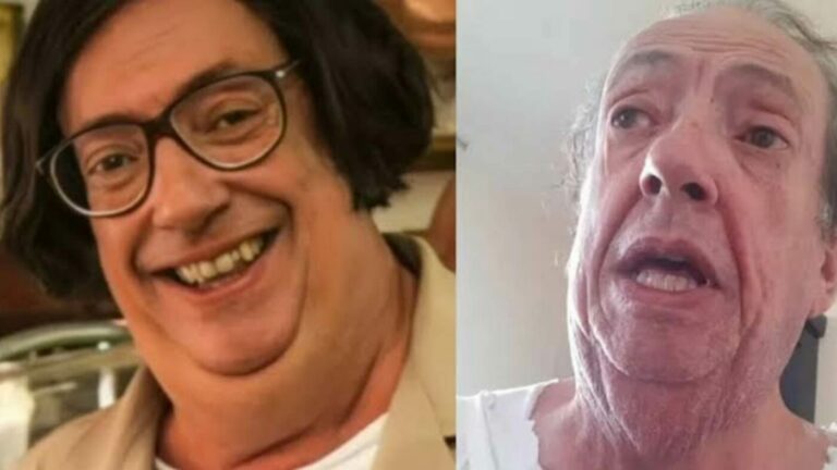 Ator global fala sobre sofrimento nos bastidores “ligado a sondas” 