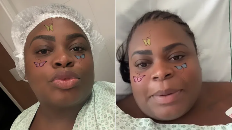 Após cirurgia bariátrica, Jojo Todynho atualiza fãs sobre estado de saúde