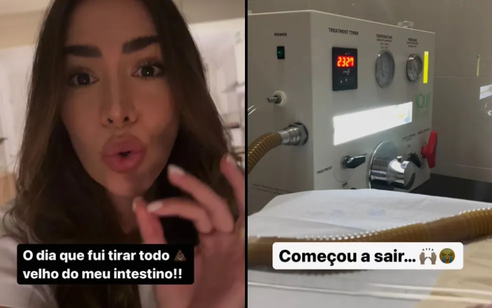 Influencer Adriana Sant'Anna faz hidrocolonterapia e mostra procedimento para 'tirar cocô velho' — Foto: Reprodução/ Redes sociais

