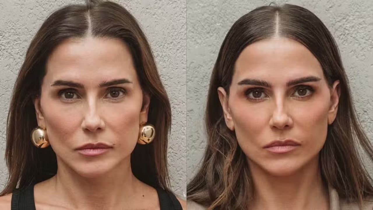 Você conhece o transplante de sobrancelhas?