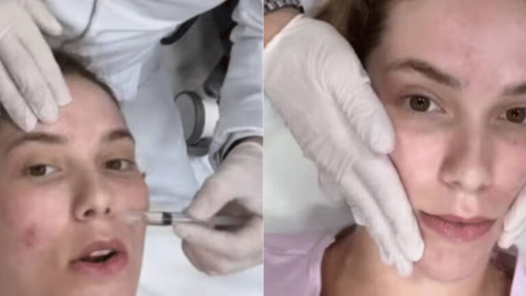 Virginia Fonseca e o tratamento facial com esperma de salmão: entenda a polêmica