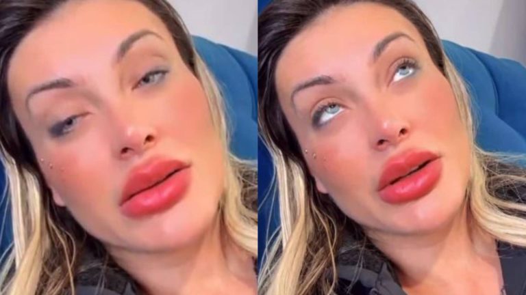 Andressa Urach teme ficar cega após procedimento para mudar cor dos olhos: “Tá doendo bastante”