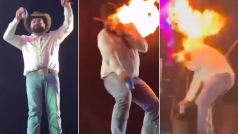 Cantor Léo Oliveira, da dupla Léo & Raphael, mostra queimaduras no rosto após acidente em show