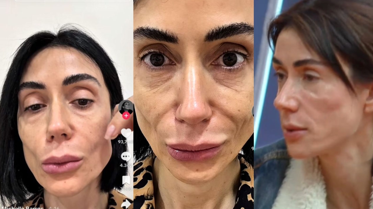 Antes e depois Michelle Barros